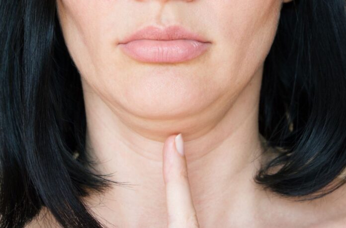 a picture of a woman's second chin