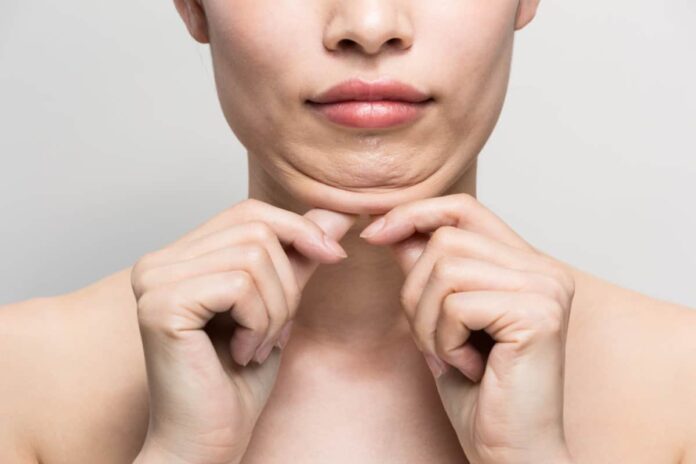 woman and the chin problem